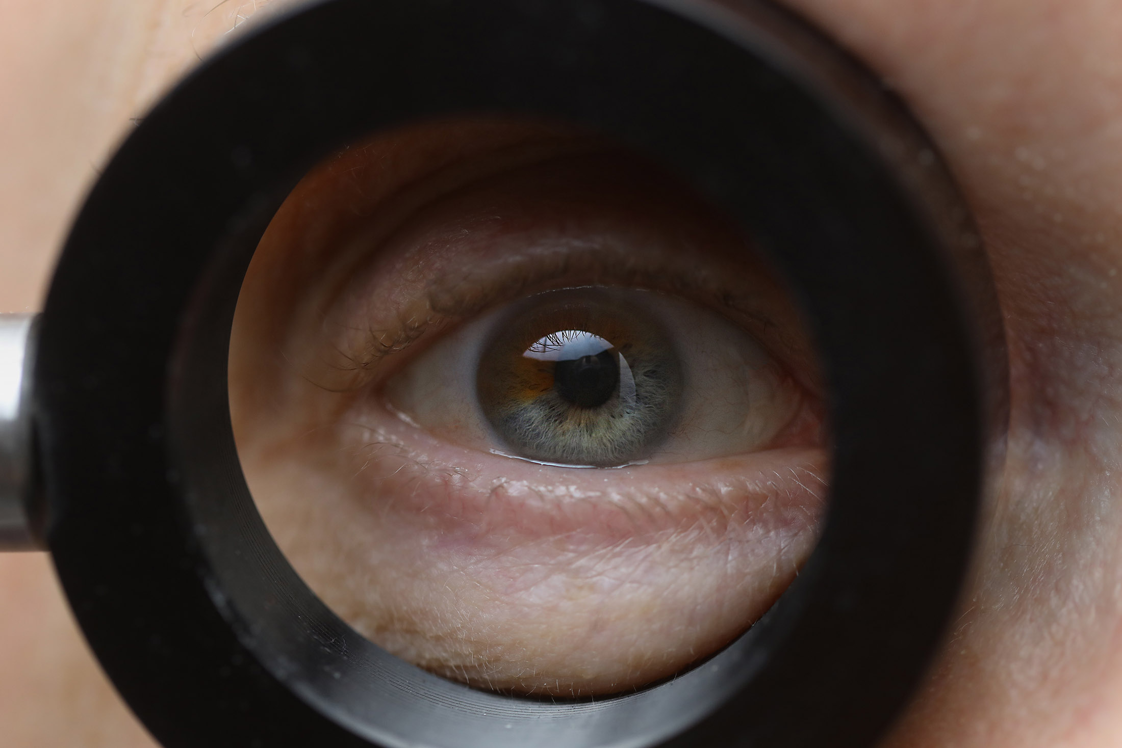 Eyeball as viewed by optical glucometer